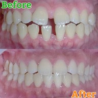 เมนูของร้าน The Color Smile Dental Clinic ปทุมธานี