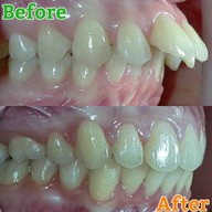 เมนูของร้าน The Color Smile Dental Clinic ปทุมธานี