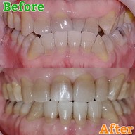 เมนูของร้าน The Color Smile Dental Clinic ปทุมธานี