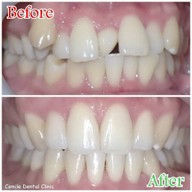 เมนูของร้าน The Color Smile Dental Clinic ปทุมธานี