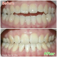 เมนูของร้าน The Color Smile Dental Clinic ปทุมธานี