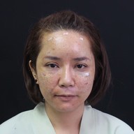 P10 Clinic ( Surgery Cosmetic ) เมเจอร์รัชโยธิน
