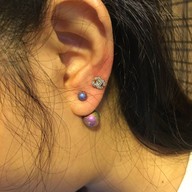 ภาคินแทงยับ รับเจาะร่างกาย 1