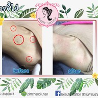 Beauty station สถานีความงาม ขอนแก่น บ้านกอก