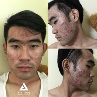 เมนูของร้าน ATTITUDE CLINIC เชียงราย