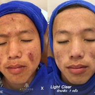 เมนูของร้าน ATTITUDE CLINIC เชียงราย