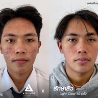 เมนูของร้าน ATTITUDE CLINIC เชียงราย