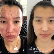 เมนูของร้าน ATTITUDE CLINIC เชียงราย