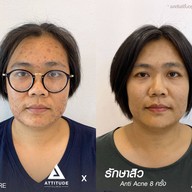 เมนูของร้าน ATTITUDE CLINIC เชียงราย