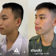 เมนูของร้าน ATTITUDE CLINIC เชียงราย