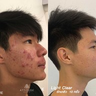 เมนูของร้าน ATTITUDE CLINIC เชียงราย