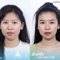 เมนูของร้าน ATTITUDE CLINIC เชียงราย