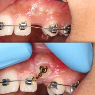 ศาลาแดง ซ.1 ทันตกรรม (SDC1st Dentist)