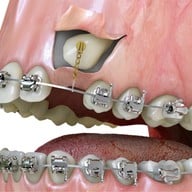 ศาลาแดง ซ.1 ทันตกรรม (SDC1st Dentist)