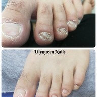 Lilyqueen Nails&spa สระบุรี