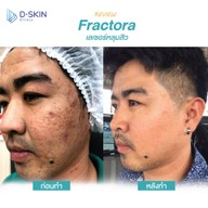 D-Skin Laser Clinic