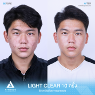 เมนูของร้าน ATTITUDE CLINIC เชียงราย