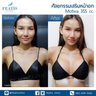 Featis Clinic ทองหล่อ