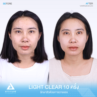 เมนูของร้าน ATTITUDE CLINIC เชียงราย