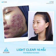 เมนูของร้าน ATTITUDE CLINIC เชียงราย