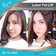 SLC Siam Laser Clinic สยามสแควร์วัน