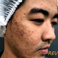 D-Skin Laser Clinic