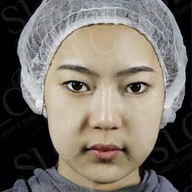 SLC Siam Laser Clinic สยามสแควร์วัน