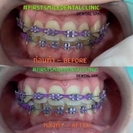 First Smile Dental Clinic