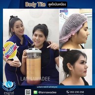 ลานนาวดีคลีนิค มีโชคพลาซ่า