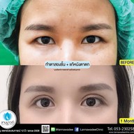 ลานนาวดีคลีนิค มีโชคพลาซ่า