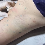 SLC Siam Laser Clinic สยามสแควร์วัน