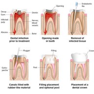 คลินิกทันตกรรมเด็นตัลสแควร์ สี่แยกเหม่งจ๋าย