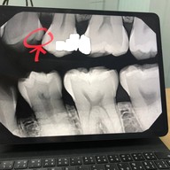 คลินิกทันตกรรมเด็นตัลสแควร์ สี่แยกเหม่งจ๋าย