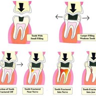 คลินิกทันตกรรมเด็นตัลสแควร์ สี่แยกเหม่งจ๋าย