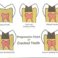 คลินิกทันตกรรมเด็นตัลสแควร์ สี่แยกเหม่งจ๋าย
