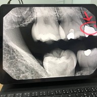 คลินิกทันตกรรมเด็นตัลสแควร์ สี่แยกเหม่งจ๋าย