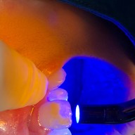 คลินิกทันตกรรมเด็นตัลสแควร์ สี่แยกเหม่งจ๋าย