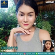 เอลิแกนซ์ คลินิก By หมอภูเบศ จันทร์ดี
