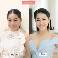 Blossom clinic สเตเดี้ยมวัน
