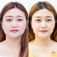 Blossom clinic สเตเดี้ยมวัน