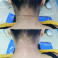 Waxing Home Chiangmai แว็กซ์ขนเชียงใหม่ที่หนึ่งเรื่องบิกินี่แว็กซ์