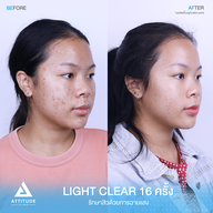 เมนูของร้าน Attitude Clinic ลำปาง