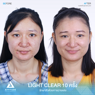 เมนูของร้าน Attitude Clinic ลำปาง