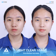 เมนูของร้าน Attitude Clinic ลำปาง