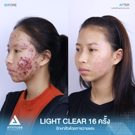 เมนูของร้าน Attitude Clinic ลำปาง