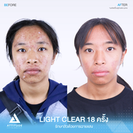 เมนูของร้าน Attitude Clinic ลำปาง