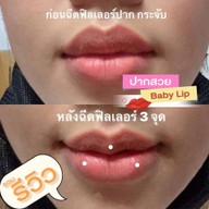 Helene Seoul Clinic ลาดพร้าว 71 นาคนิวาส 13