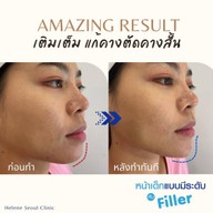 Helene Seoul Clinic ลาดพร้าว 71 นาคนิวาส 13