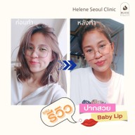 Helene Seoul Clinic ลาดพร้าว 71 นาคนิวาส 13