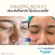 Helene Seoul Clinic ลาดพร้าว 71 นาคนิวาส 13